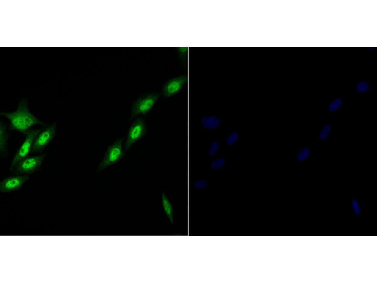 ICC staining of Brd4 in A549 cells (green). Formalin fixed cells were permeabilized with 0.1% Triton X-100 in TBS for 10 minutes at room temperature and blocked with 10% negative goat serum for 15 minutes at room temperature. Cells were probed with the primary antibody (ER1901-02, 1/200) for 1 hour at room temperature, washed with PBS. Alexa Fluor®488 conjugate-Goat anti-Rabbit IgG was used as the secondary antibody at 1/1,000 dilution. The nuclear counter stain is DAPI (blue).