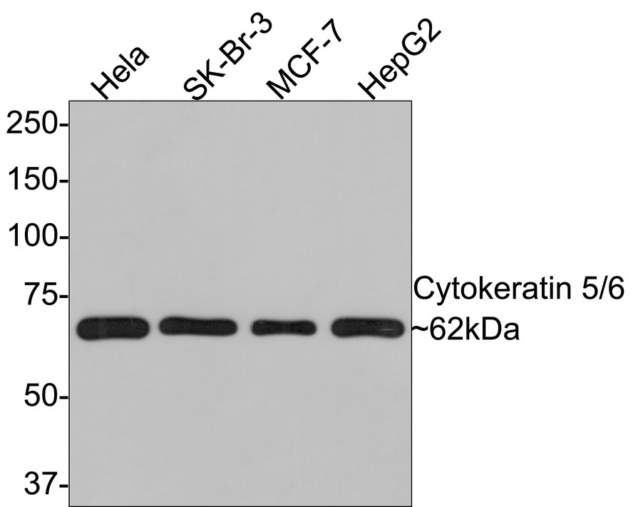 Western blot analysis of Cytokeratin 5/6 on different lysates with Rabbit anti-Cytokeratin 5/6 antibody (ER1901-03) at 1/500 dilution.<br />
<br />
Lane 1: Hela cell lysate<br />
Lane 2: SK-Br-3 cell lysate<br />
Lane 3: MCF-7 cell lysate<br />
Lane 4: HepG2 cell lysate<br />
<br />
Lysates/proteins at 10 µg/Lane.<br />
<br />
Predicted band size: 62 kDa<br />
Observed band size: 62 kDa<br />
<br />
Exposure time: 2 minutes;<br />
<br />
8% SDS-PAGE gel.<br />
<br />
Proteins were transferred to a PVDF membrane and blocked with 5% NFDM/TBST for 1 hour at room temperature. The primary antibody (ER1901-03) at 1/500 dilution was used in 5% NFDM/TBST at room temperature for 2 hours. Goat Anti-Rabbit IgG - HRP Secondary Antibody (HA1001) at 1:300,000 dilution was used for 1 hour at room temperature.