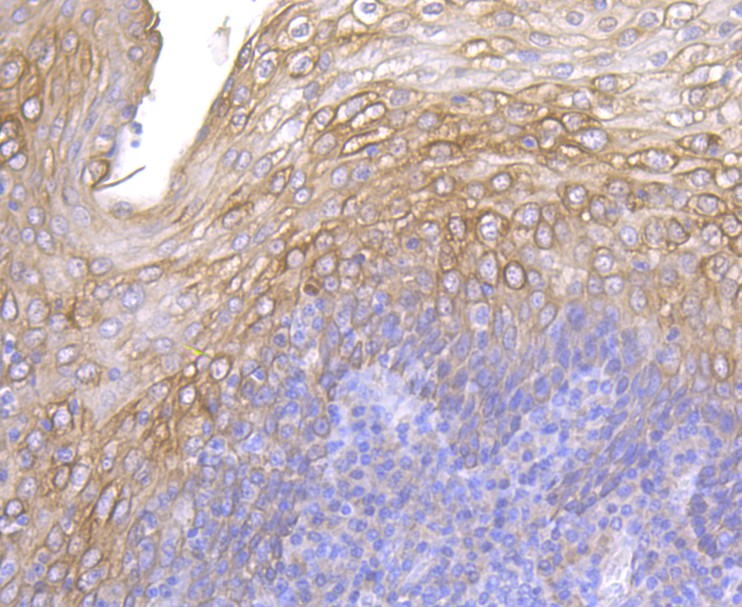 Immunohistochemical analysis of paraffin-embedded human tonsil tissue using anti-Cytokeratin 5/6 antibody. The section was pre-treated using heat mediated antigen retrieval with sodium citrate buffer (pH 6.0) for 20 minutes. The tissues were blocked in 5% BSA for 30 minutes at room temperature, washed with ddH2O and PBS, and then probed with the antibody (ER1901-03) at 1/200 dilution, for 30 minutes at room temperature and detected using an HRP conjugated compact polymer system. DAB was used as the chromogen. Counter stained with hematoxylin and mounted with DPX.