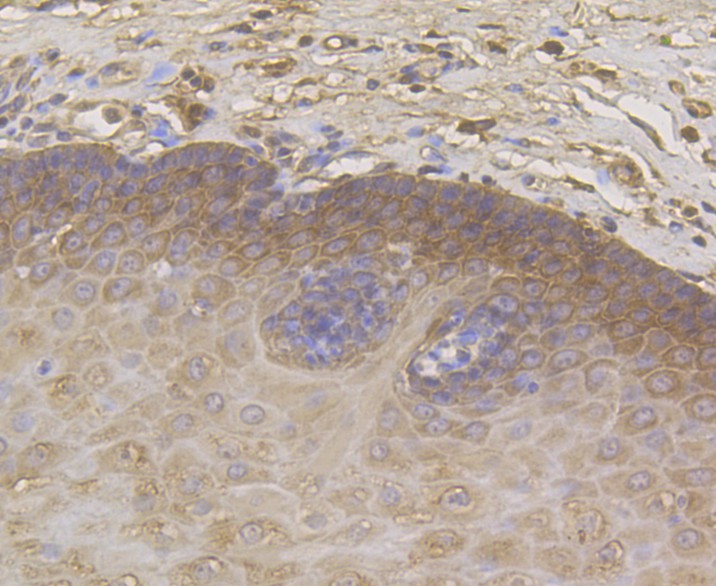 Immunohistochemical analysis of paraffin-embedded human esophagus tissue using anti-Cytokeratin 5/6 antibody. The section was pre-treated using heat mediated antigen retrieval with sodium citrate buffer (pH 6.0) for 20 minutes. The tissues were blocked in 5% BSA for 30 minutes at room temperature, washed with ddH2O and PBS, and then probed with the antibody (ER1901-03) at 1/50 dilution, for 30 minutes at room temperature and detected using an HRP conjugated compact polymer system. DAB was used as the chromogen. Counter stained with hematoxylin and mounted with DPX.