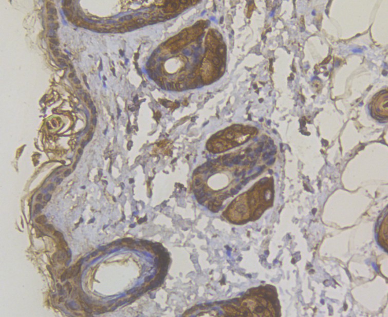 Immunohistochemical analysis of paraffin-embedded mouse skin tissue using anti-Cytokeratin 5/6 antibody. The section was pre-treated using heat mediated antigen retrieval with sodium citrate buffer (pH 6.0) for 20 minutes. The tissues were blocked in 5% BSA for 30 minutes at room temperature, washed with ddH2O and PBS, and then probed with the antibody (ER1901-03) at 1/200 dilution, for 30 minutes at room temperature and detected using an HRP conjugated compact polymer system. DAB was used as the chromogen. Counter stained with hematoxylin and mounted with DPX.