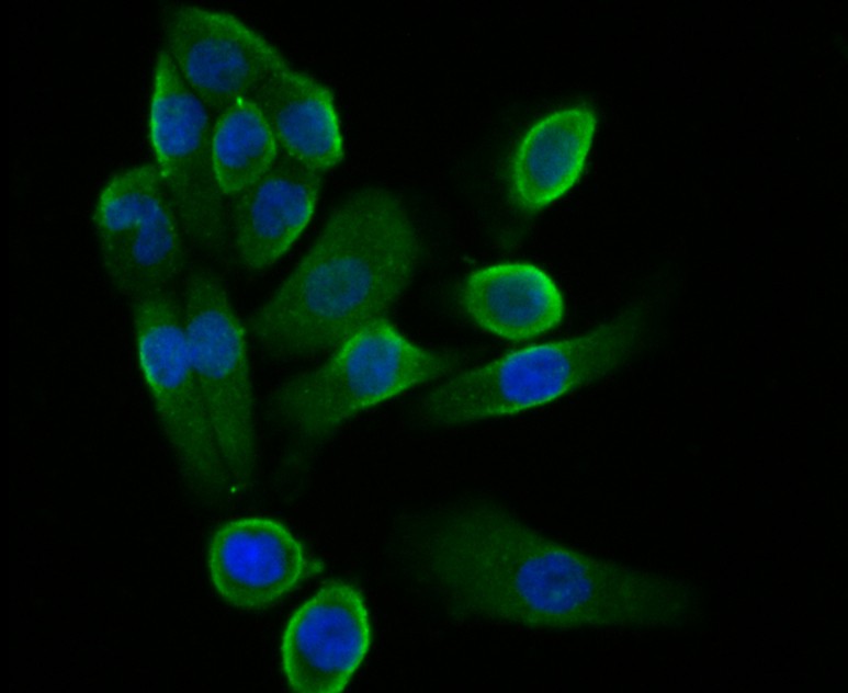 ICC staining of STIM2 in AGS cells (green). Formalin fixed cells were permeabilized with 0.1% Triton X-100 in TBS for 10 minutes at room temperature and blocked with 1% Blocker BSA for 15 minutes at room temperature. Cells were probed with the antibody (ER1901-04) at a dilution of 1:100 for 1 hour at room temperature, washed with PBS. Alexa Fluor®488 Goat anti-Rabbit IgG was used as the secondary antibody at 1/100 dilution. The nuclear counter stain is DAPI (blue).