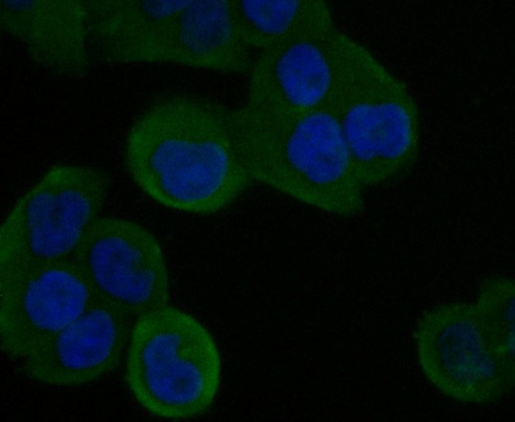 ICC staining of STIM2 in Hela cells (green). Formalin fixed cells were permeabilized with 0.1% Triton X-100 in TBS for 10 minutes at room temperature and blocked with 1% Blocker BSA for 15 minutes at room temperature. Cells were probed with the antibody (ER1901-04) at a dilution of 1:100 for 1 hour at room temperature, washed with PBS. Alexa Fluor®488 Goat anti-Rabbit IgG was used as the secondary antibody at 1/100 dilution. The nuclear counter stain is DAPI (blue).