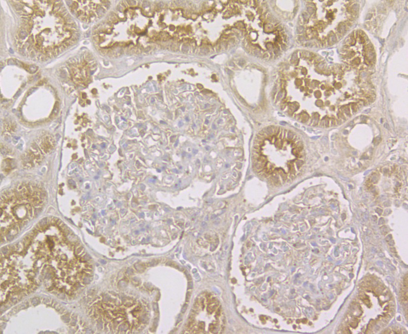 Immunohistochemical analysis of paraffin-embedded human kidney tissue using anti-STIM2 antibody. The section was pre-treated using heat mediated antigen retrieval with Tris-EDTA buffer (pH 8.0-8.4) for 20 minutes.The tissues were blocked in 5% BSA for 30 minutes at room temperature, washed with ddH2O and PBS, and then probed with the antibody (ER1901-04) at 1/200 dilution, for 30 minutes at room temperature and detected using an HRP conjugated compact polymer system. DAB was used as the chromogen. Counter stained with hematoxylin and mounted with DPX.