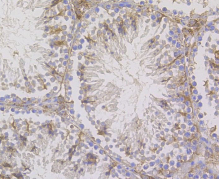 Immunohistochemical analysis of paraffin-embedded mouse testis tissue using anti-STIM2 antibody. The section was pre-treated using heat mediated antigen retrieval with Tris-EDTA buffer (pH 8.0-8.4) for 20 minutes.The tissues were blocked in 5% BSA for 30 minutes at room temperature, washed with ddH2O and PBS, and then probed with the antibody (ER1901-04) at 1/200 dilution, for 30 minutes at room temperature and detected using an HRP conjugated compact polymer system. DAB was used as the chromogen. Counter stained with hematoxylin and mounted with DPX.