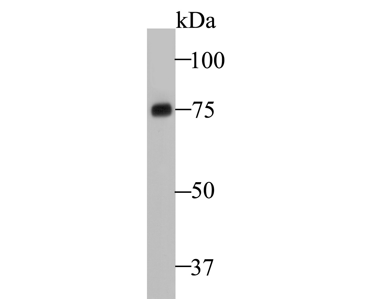 Western blot analysis of Pannexin 2 on HepG2 cell lysate. Proteins were transferred to a PVDF membrane and blocked with 5% BSA in PBS for 1 hour at room temperature. The primary antibody (ER1901-05, 1/2,000) was used in 5% BSA at room temperature for 2 hours. Goat Anti-Rabbit IgG - HRP Secondary Antibody (HA1001) at 1:5,000 dilution was used for 1 hour at room temperature.