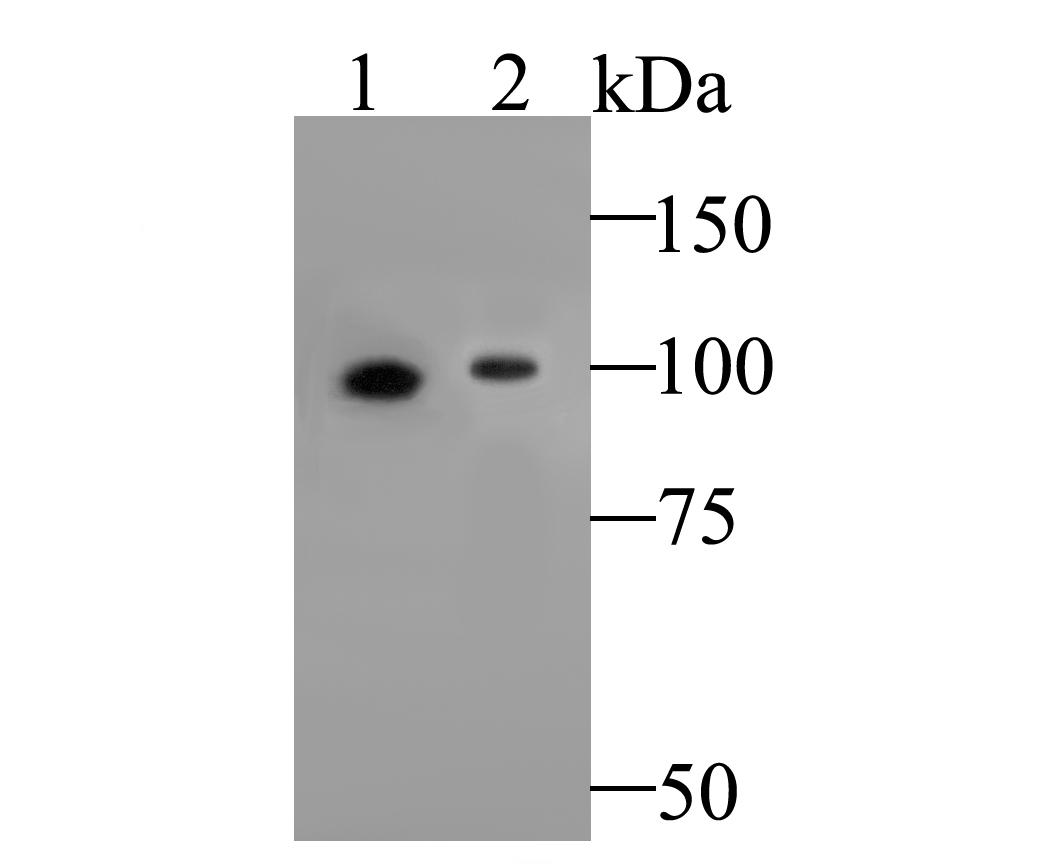 Western blot analysis of delta 1 Catenin/CAS on different lysates. Proteins were transferred to a PVDF membrane and blocked with 5% BSA in PBS for 1 hour at room temperature. The primary antibody (ER1901-07, 1/500) was used in 5% BSA at room temperature for 2 hours. Goat Anti-Rabbit IgG - HRP Secondary Antibody (HA1001) at 1:5,000 dilution was used for 1 hour at room temperature.<br />
Positive control: <br />
Lane 1: Human skin tissue lysate<br />
Lane 2: Mouse stomach tissue lysate