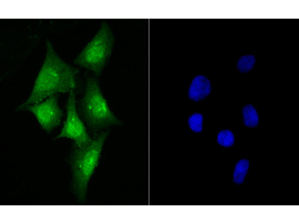 ICC staining of delta 1 Catenin/CAS in SiHa cells (green). Formalin fixed cells were permeabilized with 0.1% Triton X-100 in TBS for 10 minutes at room temperature and blocked with 1% Blocker BSA for 15 minutes at room temperature. Cells were probed with the primary antibody (ER1901-07, 1/100) for 1 hour at room temperature, washed with PBS. Alexa Fluor®488 Goat anti-Rabbit IgG was used as the secondary antibody at 1/100 dilution. The nuclear counter stain is DAPI (blue).