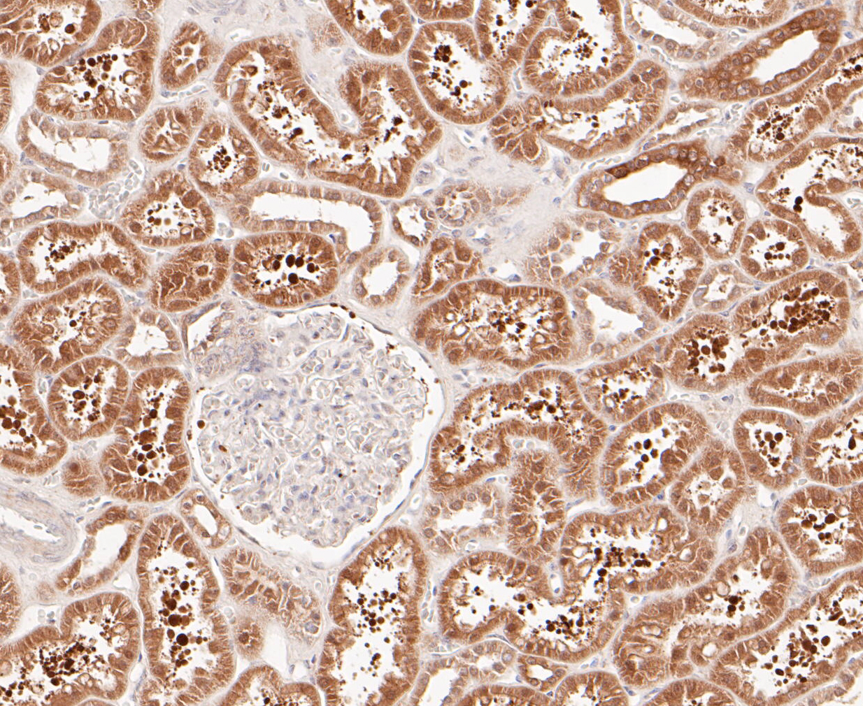 Immunohistochemical analysis of paraffin-embedded human kidney tissue using anti-delta 1 Catenin/CAS antibody. The section was pre-treated using heat mediated antigen retrieval with Tris-EDTA buffer (pH 8.0-8.4) for 20 minutes.The tissues were blocked in 5% BSA for 30 minutes at room temperature, washed with ddH2O and PBS, and then probed with the primary antibody (ER1901-07, 1/200) for 30 minutes at room temperature. The detection was performed using an HRP conjugated compact polymer system. DAB was used as the chromogen. Tissues were counterstained with hematoxylin and mounted with DPX.