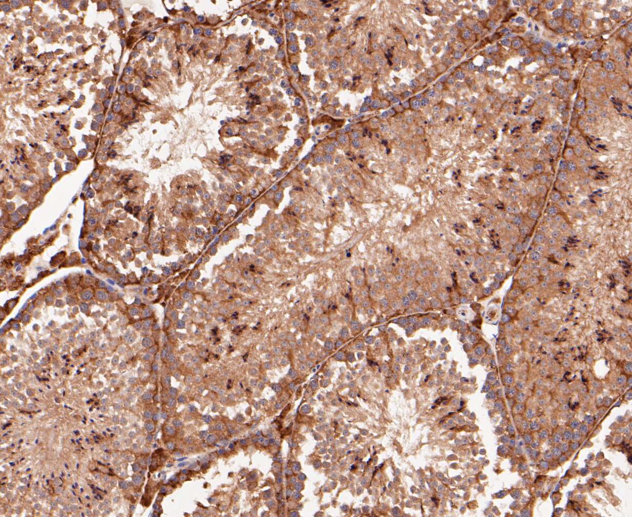 Immunohistochemical analysis of paraffin-embedded mouse testis tissue using anti-delta 1 Catenin/CAS antibody. The section was pre-treated using heat mediated antigen retrieval with Tris-EDTA buffer (pH 8.0-8.4) for 20 minutes.The tissues were blocked in 5% BSA for 30 minutes at room temperature, washed with ddH2O and PBS, and then probed with the primary antibody (ER1901-07, 1/200) for 30 minutes at room temperature. The detection was performed using an HRP conjugated compact polymer system. DAB was used as the chromogen. Tissues were counterstained with hematoxylin and mounted with DPX.
