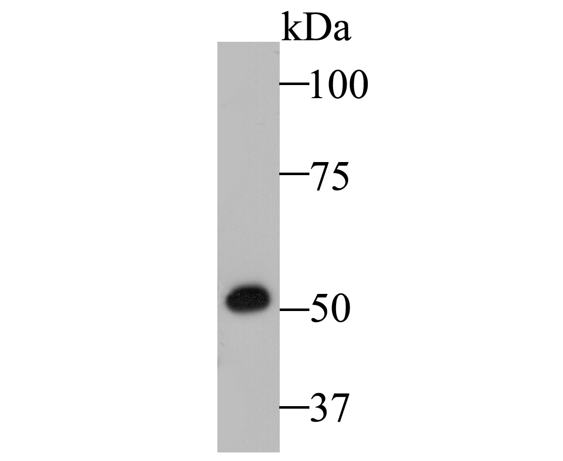 Western blot analysis of Cytokeratin 14 on A431 cell lysate. Proteins were transferred to a PVDF membrane and blocked with 5% BSA in PBS for 1 hour at room temperature. The primary antibody was used at a 1:5,000 dilution in 5% BSA at room temperature for 2 hours. Goat Anti-Rabbit IgG - HRP Secondary Antibody (HA1001) at 1:5,000 dilution was used for 1 hour at room temperature.