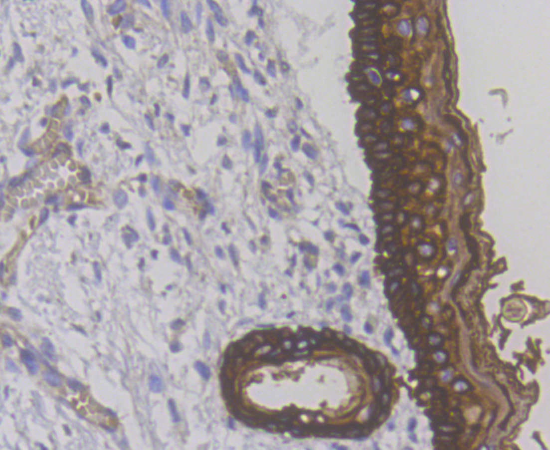Immunohistochemical analysis of paraffin-embedded human skin tissue using anti-Cytokeratin 14 antibody. The section was pre-treated using heat mediated antigen retrieval with Tris-EDTA buffer (pH 8.0-8.4) for 20 minutes.The tissues were blocked in 5% BSA for 30 minutes at room temperature, washed with ddH2O and PBS, and then probed with the primary antibody (ER1901-08,  1/200 dilution) for 30 minutes at room temperature and detected using an HRP conjugated compact polymer system. DAB was used as the chromogen. Counter stained with hematoxylin and mounted with DPX.