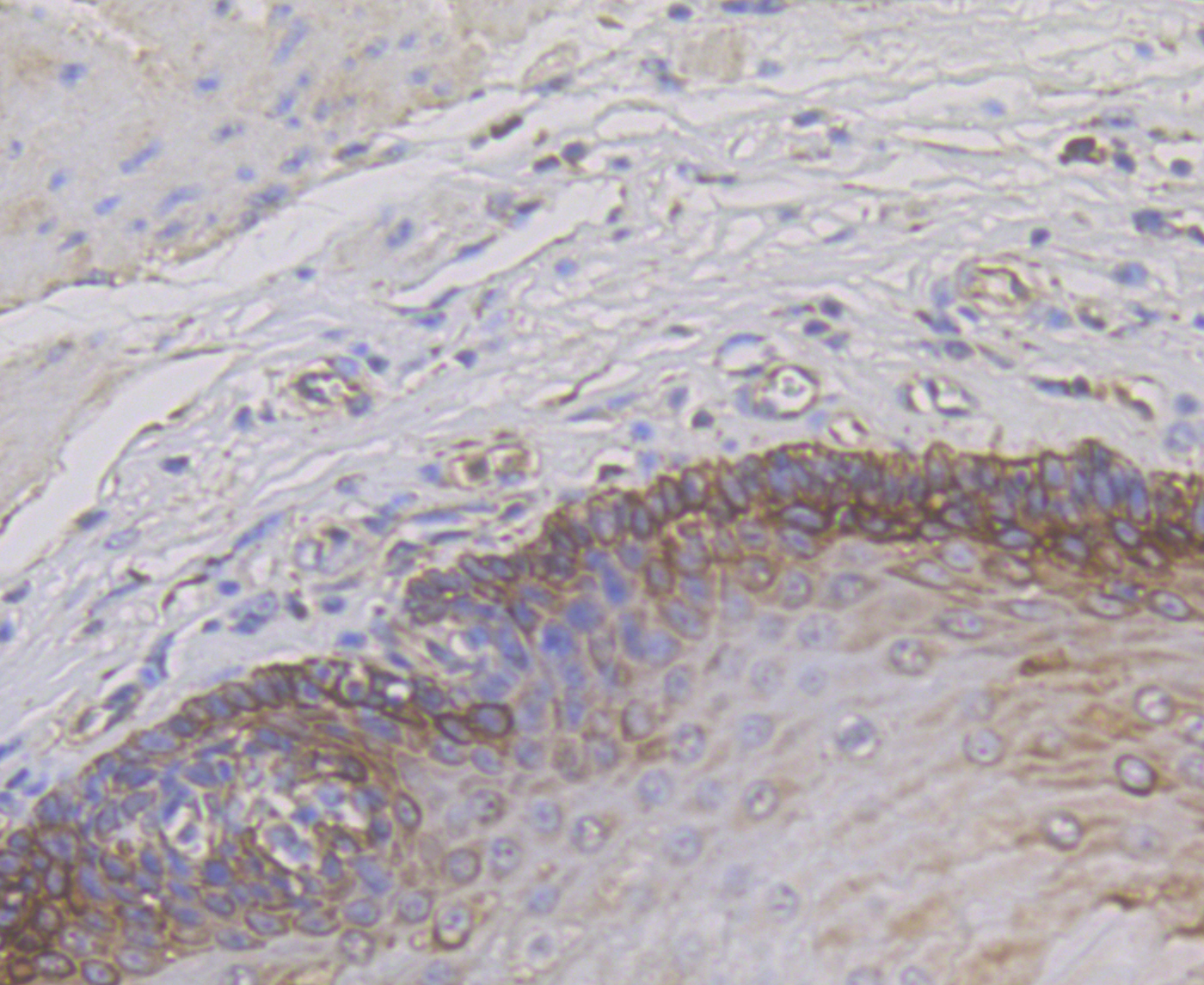 Immunohistochemical analysis of paraffin-embedded human esophagus tissue using anti-Cytokeratin 14 antibody. The section was pre-treated using heat mediated antigen retrieval with Tris-EDTA buffer (pH 8.0-8.4) for 20 minutes.The tissues were blocked in 5% BSA for 30 minutes at room temperature, washed with ddH2O and PBS, and then probed with the primary antibody (ER1901-08,  1/200 dilution) for 30 minutes at room temperature and detected using an HRP conjugated compact polymer system. DAB was used as the chromogen. Counter stained with hematoxylin and mounted with DPX.