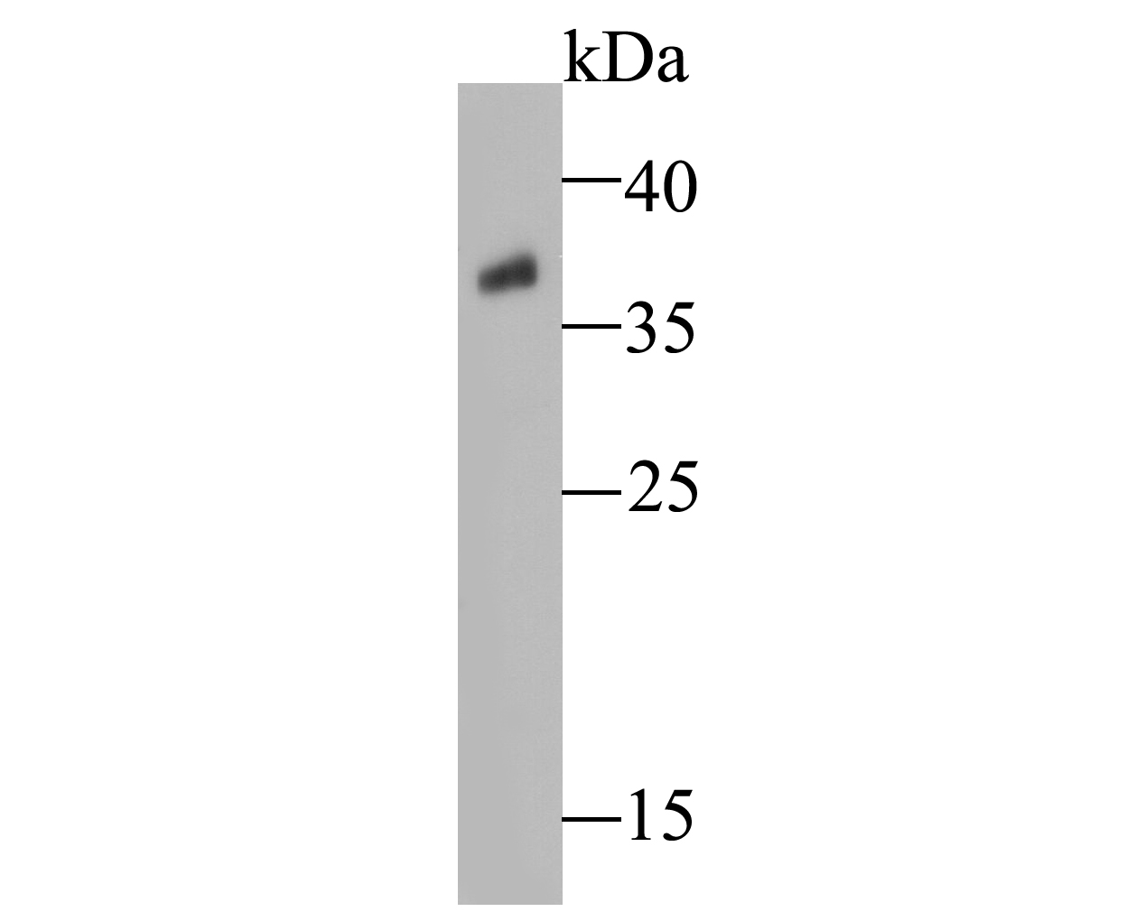 Western blot analysis of Rice Os01g0847700 protein on rice stem lysates. Proteins were transferred to a PVDF membrane and blocked with 5% BSA in PBS for 1 hour at room temperature. The primary antibody (ER1901-09, 1/500) was used in 5% BSA at room temperature for 2 hours. Goat Anti-Rabbit IgG - HRP Secondary Antibody (HA1001) at 1:5,000 dilution was used for 1 hour at room temperature.