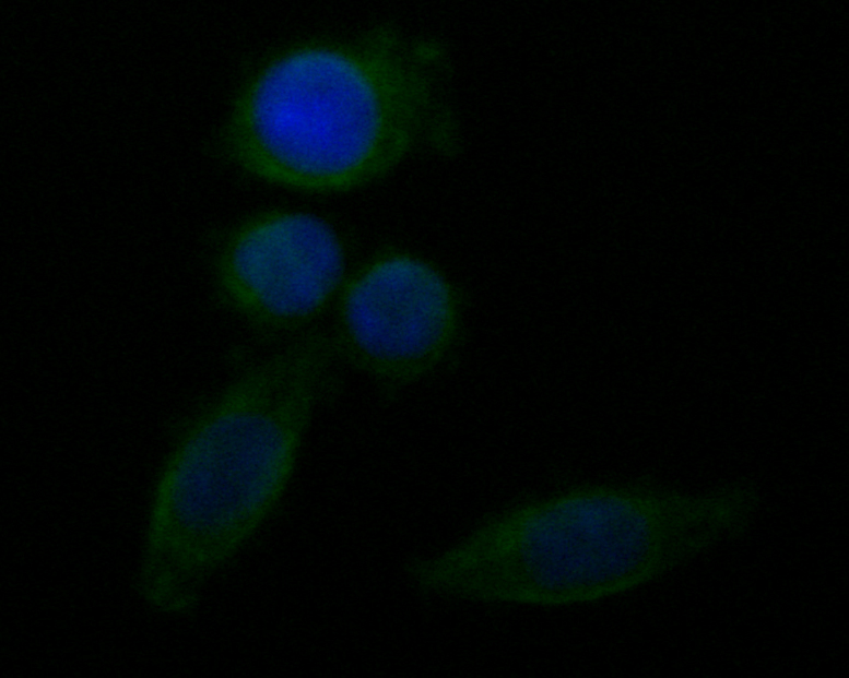 ICC staining of FH in SW620 cells (green). Formalin fixed cells were permeabilized with 0.1% Triton X-100 in TBS for 10 minutes at room temperature and blocked with 1% Blocker BSA for 15 minutes at room temperature. Cells were probed with the primary antibody (ER1901-10, 1/50) for 1 hour at room temperature, washed with PBS. Alexa Fluor®488 Goat anti-Rabbit IgG was used as the secondary antibody at 1/1,000 dilution. The nuclear counter stain is DAPI (blue).