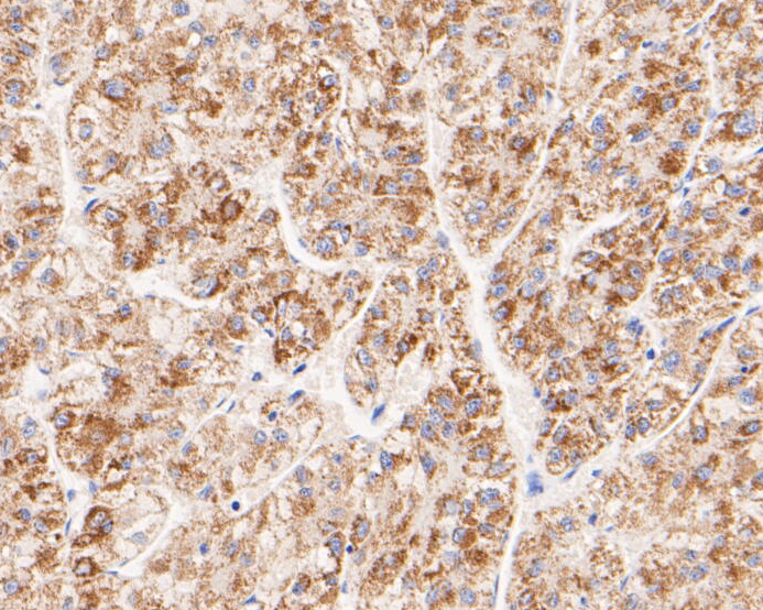 Immunocytochemistry analysis of A431 cells labeling FH with Rabbit anti-FH antibody (ER1901-10) at 1/50 dilution.<br />
<br />
Cells were fixed in 4% paraformaldehyde for 10 minutes at 37 ℃, permeabilized with 0.05% Triton X-100 in PBS for 20 minutes, and then blocked with 2% negative goat serum for 30 minutes at room temperature. Cells were then incubated with Rabbit anti-FH antibody (ER1901-10) at 1/50 dilution in 2% negative goat serum overnight at 4 ℃. Goat Anti-Rabbit IgG H&L (iFluor™ 488, HA1121) was used as the secondary antibody at 1/1,000 dilution. PBS instead of the primary antibody was used as the secondary antibody only control. Nuclear DNA was labelled in blue with DAPI.