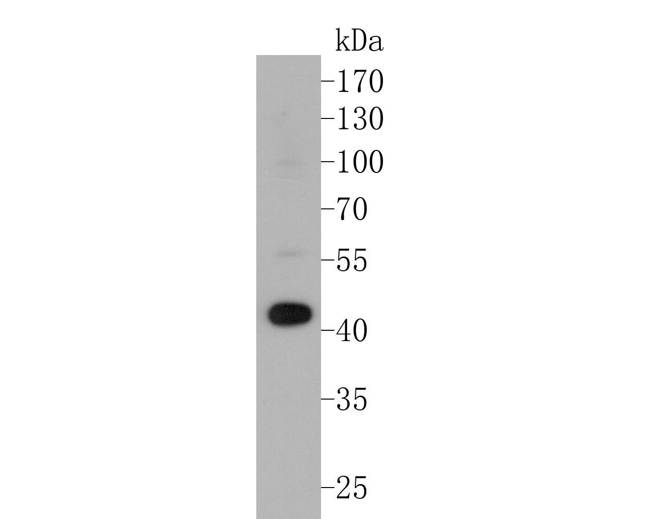 Western blot analysis of ACADL on SH-SY5Y cell lysate. Proteins were transferred to a PVDF membrane and blocked with 5% BSA in PBS for 1 hour at room temperature. The primary antibody (ER1901-11, 1/5000) was used in 5% BSA at room temperature for 2 hours. Goat Anti-Rabbit IgG - HRP Secondary Antibody (HA1001) at 1:5,000 dilution was used for 1 hour at room temperature.