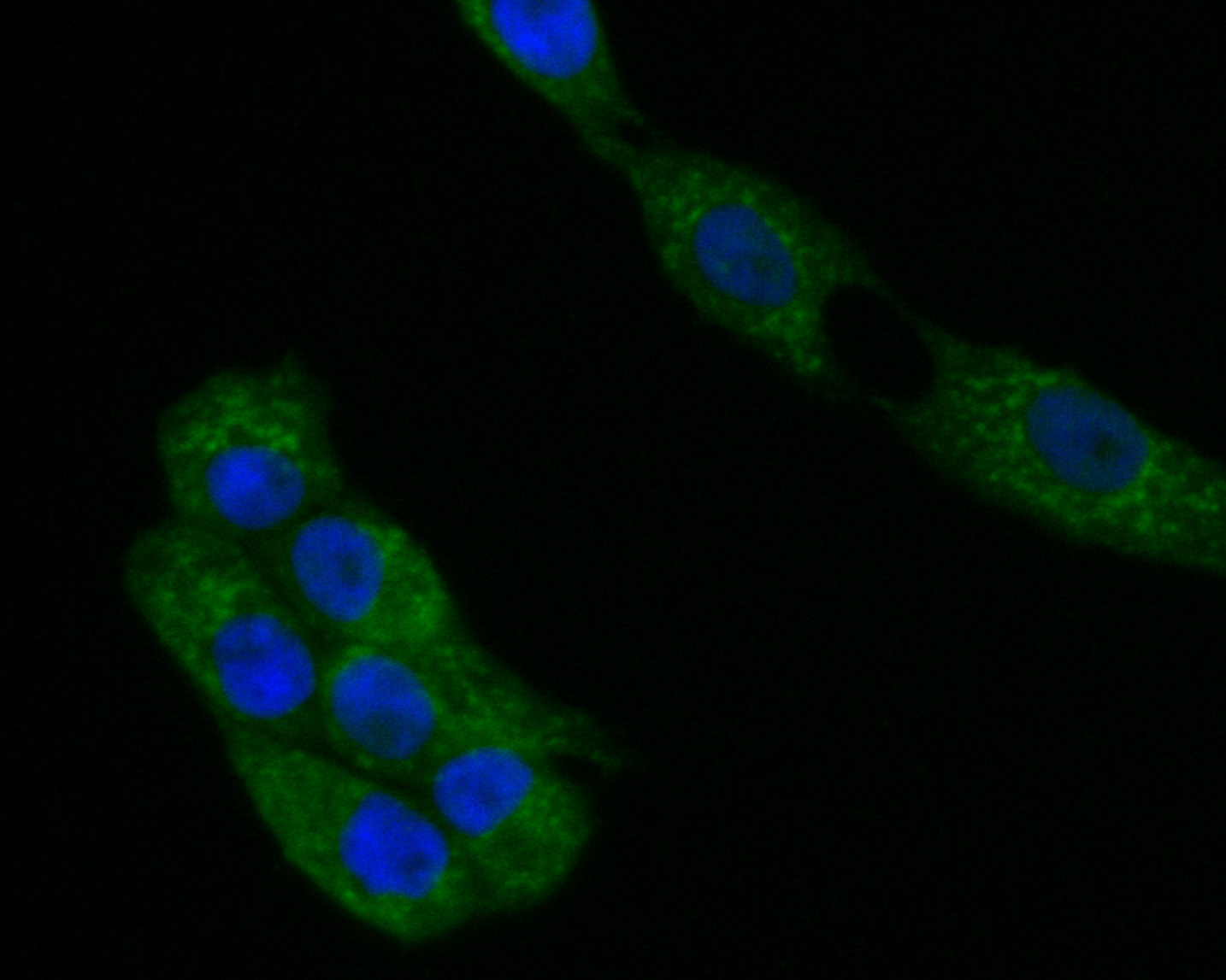 ICC staining of ACADL in MG-63 cells (green). Formalin fixed cells were permeabilized with 0.1% Triton X-100 in TBS for 10 minutes at room temperature and blocked with 1% Blocker BSA for 15 minutes at room temperature. Cells were probed with the primary antibody (ER1901-11, 1/50) for 1 hour at room temperature, washed with PBS. Alexa Fluor®488 Goat anti-Rabbit IgG was used as the secondary antibody at 1/1,000 dilution. The nuclear counter stain is DAPI (blue).
