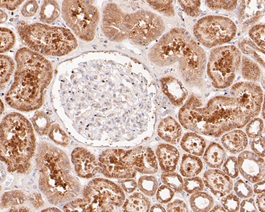 Immunohistochemical analysis of paraffin-embedded human kidney tissue using anti-ACADL antibody. The section was pre-treated using heat mediated antigen retrieval with Tris-EDTA buffer (pH 8.0-8.4) for 20 minutes.The tissues were blocked in 5% BSA for 30 minutes at room temperature, washed with ddH2O and PBS, and then probed with the primary antibody (ER1901-11, 1/50) for 30 minutes at room temperature. The detection was performed using an HRP conjugated compact polymer system. DAB was used as the chromogen. Tissues were counterstained with hematoxylin and mounted with DPX.