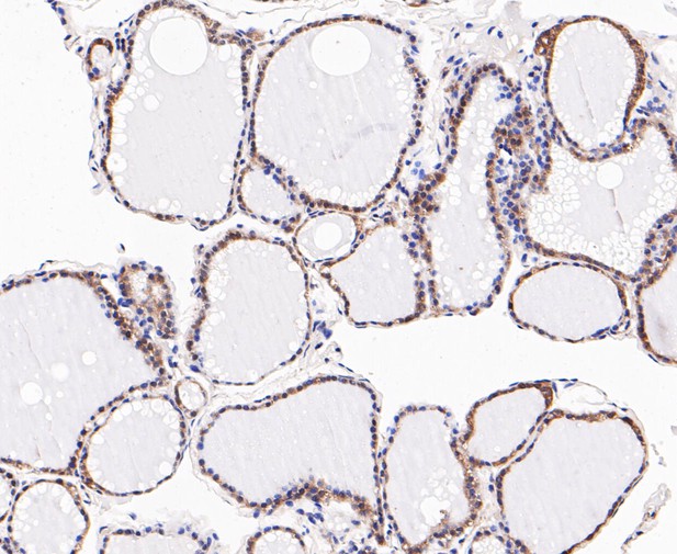 Immunohistochemical analysis of paraffin-embedded rat testis tissue using anti-DFNA5/GSDME antibody. The section was pre-treated using heat mediated antigen retrieval with Tris-EDTA buffer (pH 8.0-8.4) for 20 minutes.The tissues were blocked in 5% BSA for 30 minutes at room temperature, washed with ddH2O and PBS, and then probed with the primary antibody (ER1901-12, 1/200) for 30 minutes at room temperature. The detection was performed using an HRP conjugated compact polymer system. DAB was used as the chromogen. Tissues were counterstained with hematoxylin and mounted with DPX.