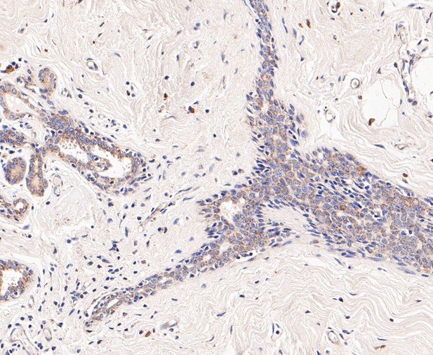 Immunohistochemical analysis of paraffin-embedded human thyroid gland tissue using anti-DFNA5/GSDME antibody. The section was pre-treated using heat mediated antigen retrieval with Tris-EDTA buffer (pH 8.0-8.4) for 20 minutes.The tissues were blocked in 5% BSA for 30 minutes at room temperature, washed with ddH2O and PBS, and then probed with the primary antibody (ER1901-12, 1/200) for 30 minutes at room temperature. The detection was performed using an HRP conjugated compact polymer system. DAB was used as the chromogen. Tissues were counterstained with hematoxylin and mounted with DPX.