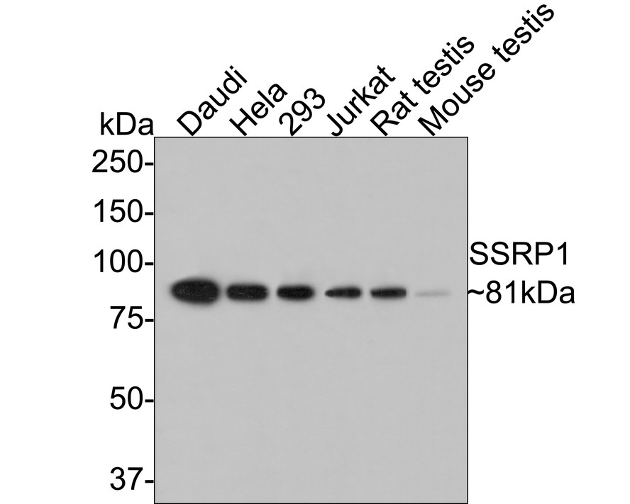 Western blot analysis of SSRP1 on Daudi cell lysate. Proteins were transferred to a PVDF membrane and blocked with 5% BSA in PBS for 1 hour at room temperature. The primary antibody (ER1901-13, 1/500) was used in 5% BSA at room temperature for 2 hours. Goat Anti-Rabbit IgG - HRP Secondary Antibody (HA1001) at 1:5,000 dilution was used for 1 hour at room temperature.