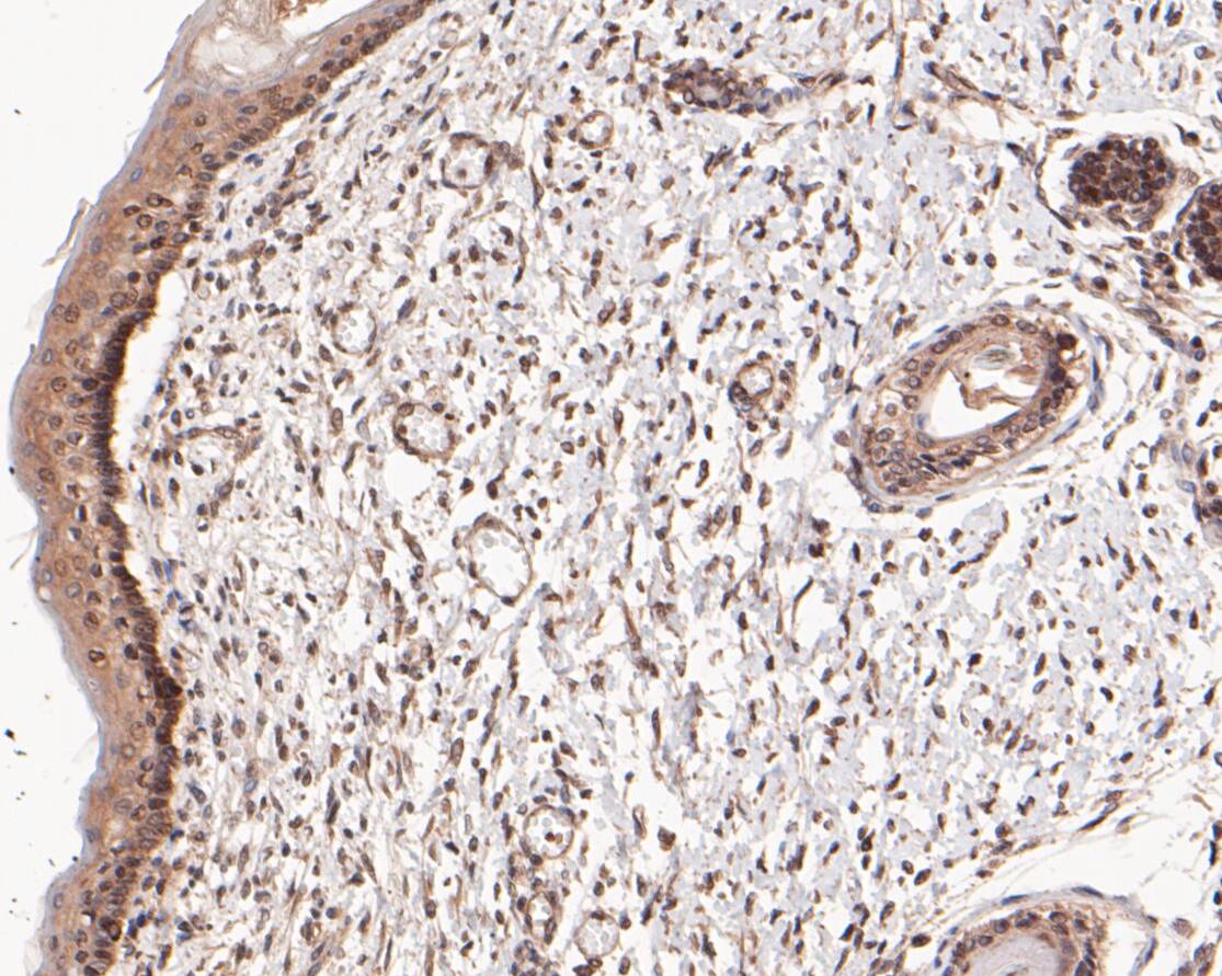 Immunohistochemical analysis of paraffin-embedded human skin tissue using anti-SSRP1 antibody. The section was pre-treated using heat mediated antigen retrieval with sodium citrate buffer (pH 6.0) for 20 minutes. The tissues were blocked in 5% BSA for 30 minutes at room temperature, washed with ddH2O and PBS, and then probed with the primary antibody (ER1901-13, 1/50)  for 30 minutes at room temperature. The detection was performed using an HRP conjugated compact polymer system. DAB was used as the chromogen. Tissues were counterstained with hematoxylin and mounted with DPX.