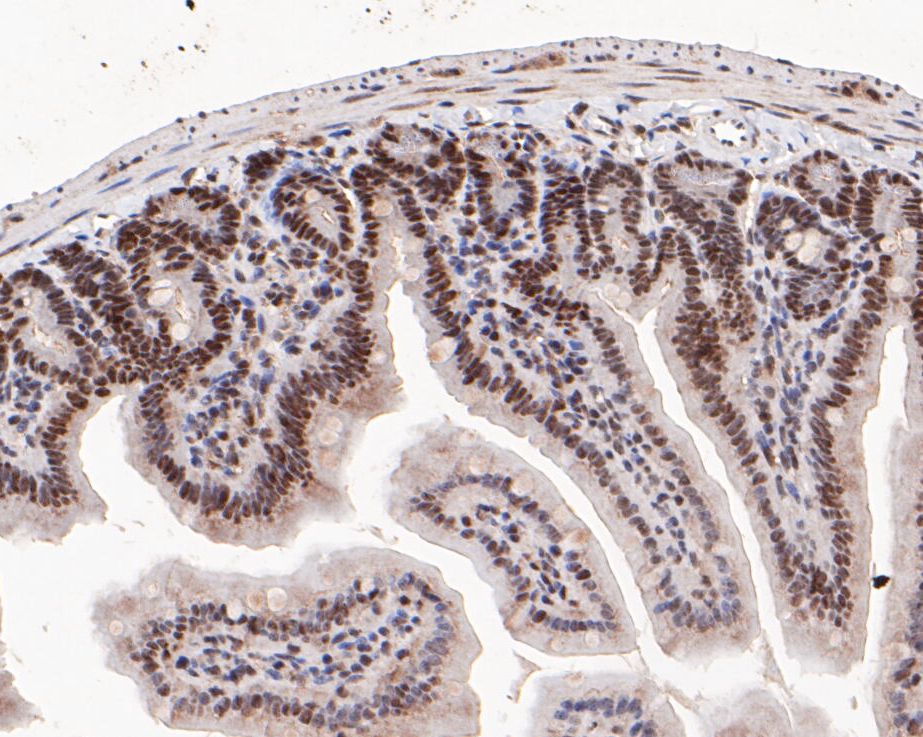 Immunohistochemical analysis of paraffin-embedded mouse colon tissue using anti-SSRP1 antibody. The section was pre-treated using heat mediated antigen retrieval with sodium citrate buffer (pH 6.0) for 20 minutes. The tissues were blocked in 5% BSA for 30 minutes at room temperature, washed with ddH2O and PBS, and then probed with the primary antibody (ER1901-13, 1/50)  for 30 minutes at room temperature. The detection was performed using an HRP conjugated compact polymer system. DAB was used as the chromogen. Tissues were counterstained with hematoxylin and mounted with DPX.
