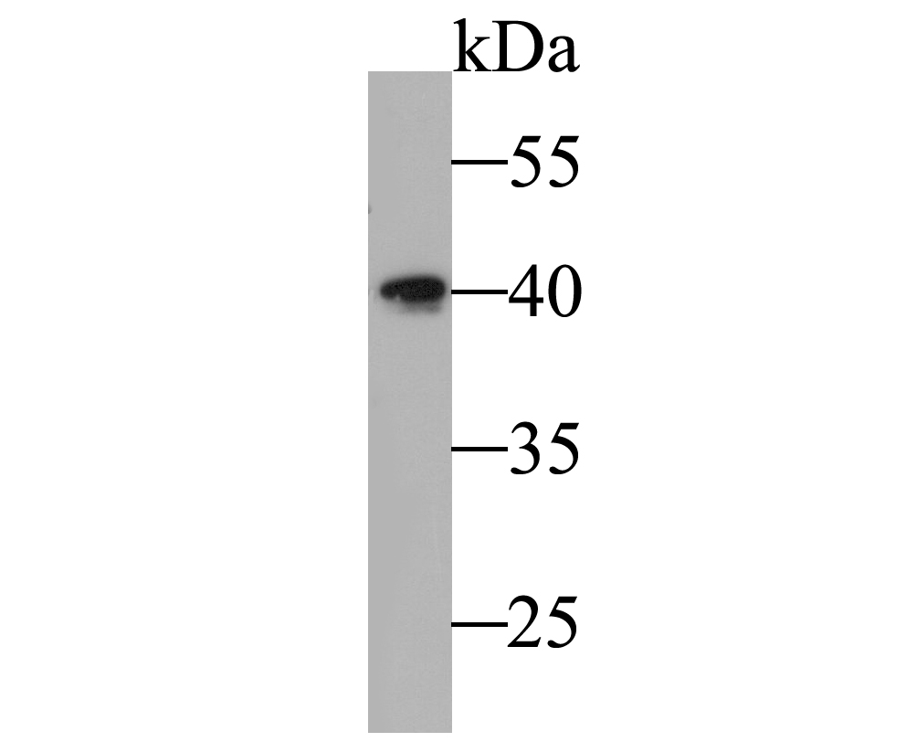 Western blot analysis of B3GAT1 on rat brain tissue lysate. Proteins were transferred to a PVDF membrane and blocked with 5% BSA in PBS for 1 hour at room temperature. The primary antibody (ER1901-15, 1/500) was used in 5% BSA at room temperature for 2 hours. Goat Anti-Rabbit IgG - HRP Secondary Antibody (HA1001) at 1:5,000 dilution was used for 1 hour at room temperature.