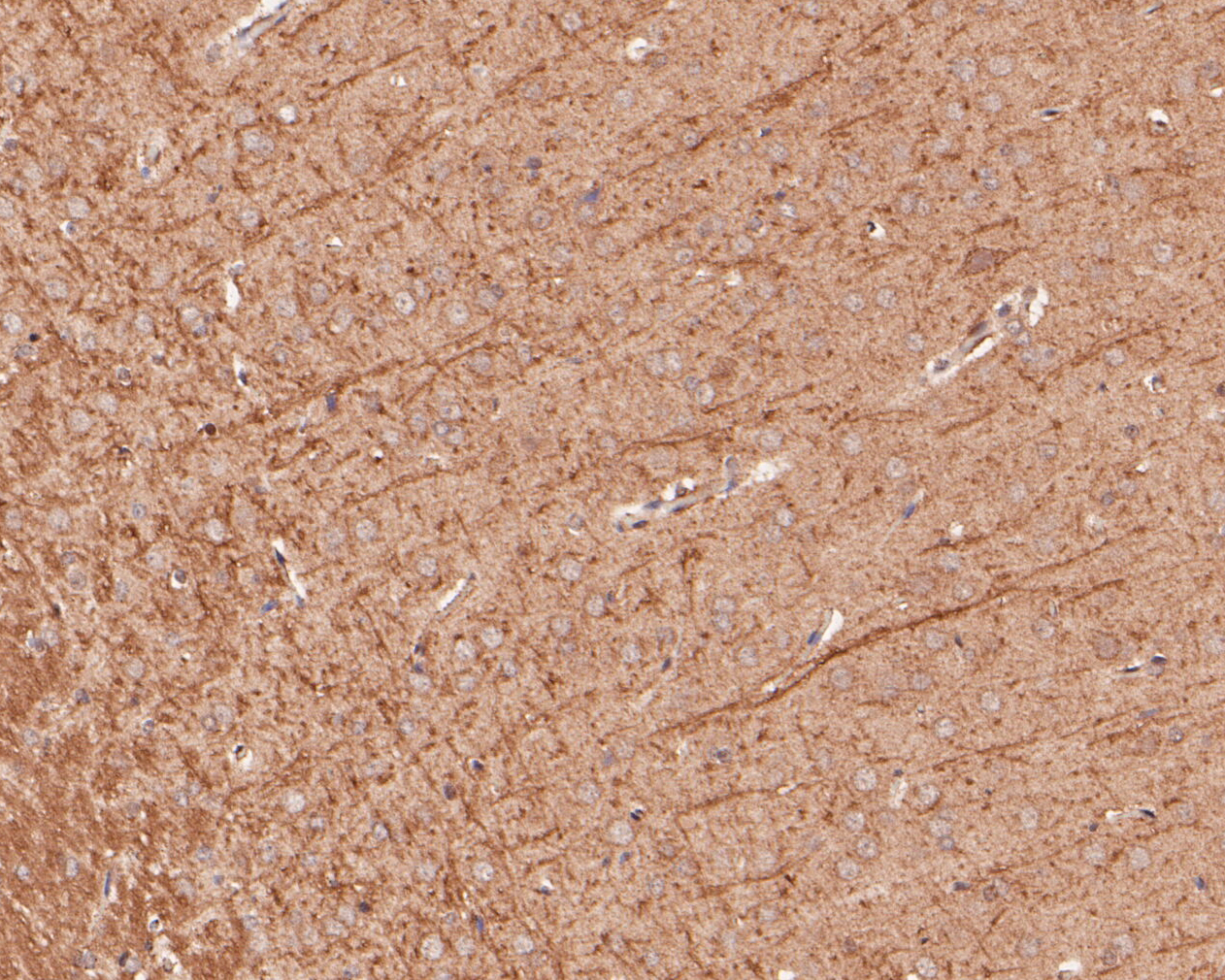 Immunohistochemical analysis of paraffin-embedded rat brain tissue using anti-B3GAT1 antibody. The section was pre-treated using heat mediated antigen retrieval with sodium citrate buffer (pH 6.0) for 20 minutes. The tissues were blocked in 5% BSA for 30 minutes at room temperature, washed with ddH2O and PBS, and then probed with the primary antibody (ER1901-15, 1/200)  for 30 minutes at room temperature. The detection was performed using an HRP conjugated compact polymer system. DAB was used as the chromogen. Tissues were counterstained with hematoxylin and mounted with DPX.