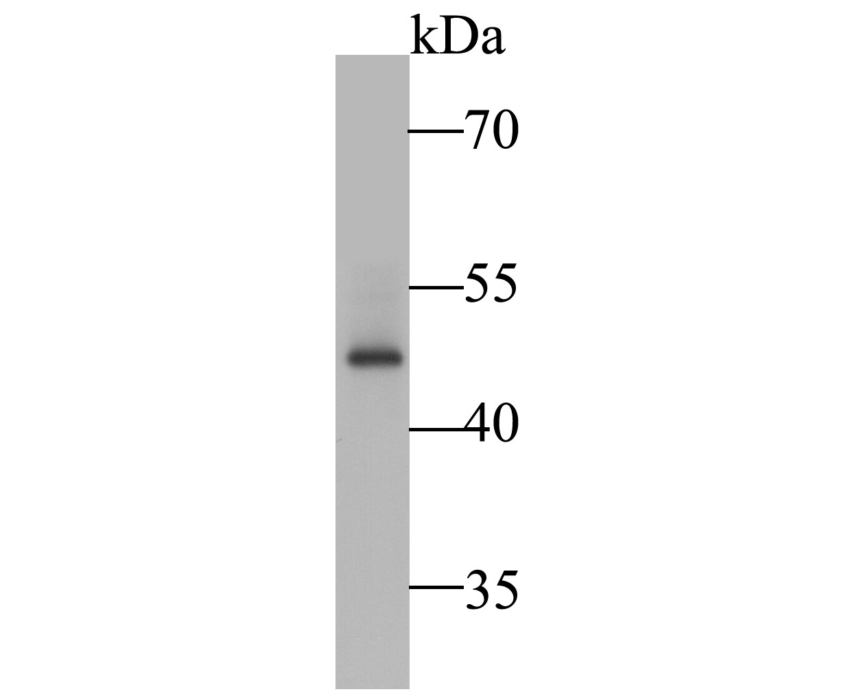 Western blot analysis of SSB on K562 cell lysate. Proteins were transferred to a PVDF membrane and blocked with 5% BSA in PBS for 1 hour at room temperature. The primary antibody (ER1901-16, 1/5,000) was used in 5% BSA at room temperature for 2 hours. Goat Anti-Rabbit IgG - HRP Secondary Antibody (HA1001) at 1:5,000 dilution was used for 1 hour at room temperature.