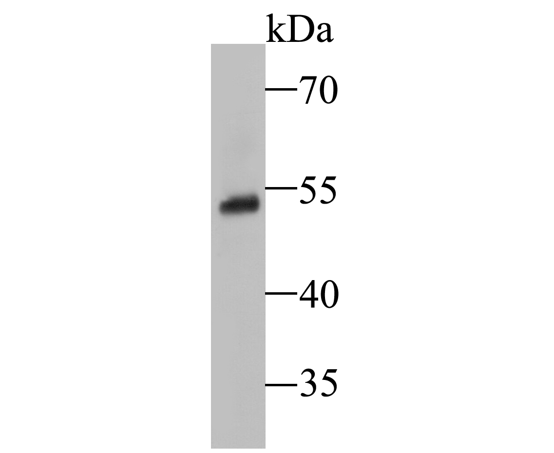 Western blot analysis of SSB on human lung tissue lysate. Proteins were transferred to a PVDF membrane and blocked with 5% BSA in PBS for 1 hour at room temperature. The primary antibody (ER1901-16, 1/1,000) was used in 5% BSA at room temperature for 2 hours. Goat Anti-Rabbit IgG - HRP Secondary Antibody (HA1001) at 1:5,000 dilution was used for 1 hour at room temperature.