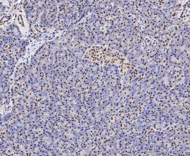 Immunohistochemical analysis of paraffin-embedded human pancreas tissue using anti-SSB antibody. The section was pre-treated using heat mediated antigen retrieval with sodium citrate buffer (pH 6.0) for 20 minutes. The tissues were blocked in 5% BSA for 30 minutes at room temperature, washed with ddH2O and PBS, and then probed with the primary antibody (ER1901-16, 1/50)  for 30 minutes at room temperature. The detection was performed using an HRP conjugated compact polymer system. DAB was used as the chromogen. Tissues were counterstained with hematoxylin and mounted with DPX.