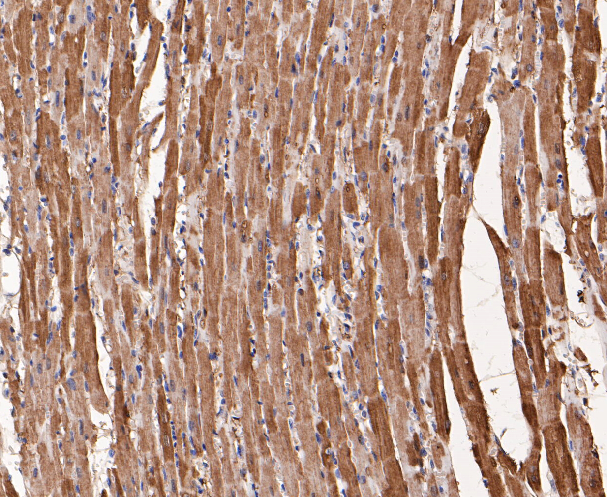 Immunohistochemical analysis of paraffin-embedded rat heart muscle tissue using anti-Myoglobin antibody. The section was pre-treated using heat mediated antigen retrieval with Tris-EDTA buffer (pH 8.0-8.4) for 20 minutes.The tissues were blocked in 5% BSA for 30 minutes at room temperature, washed with ddH2O and PBS, and then probed with the primary antibody (ER1901-17, 1/200) for 30 minutes at room temperature. The detection was performed using an HRP conjugated compact polymer system. DAB was used as the chromogen. Tissues were counterstained with hematoxylin and mounted with DPX.