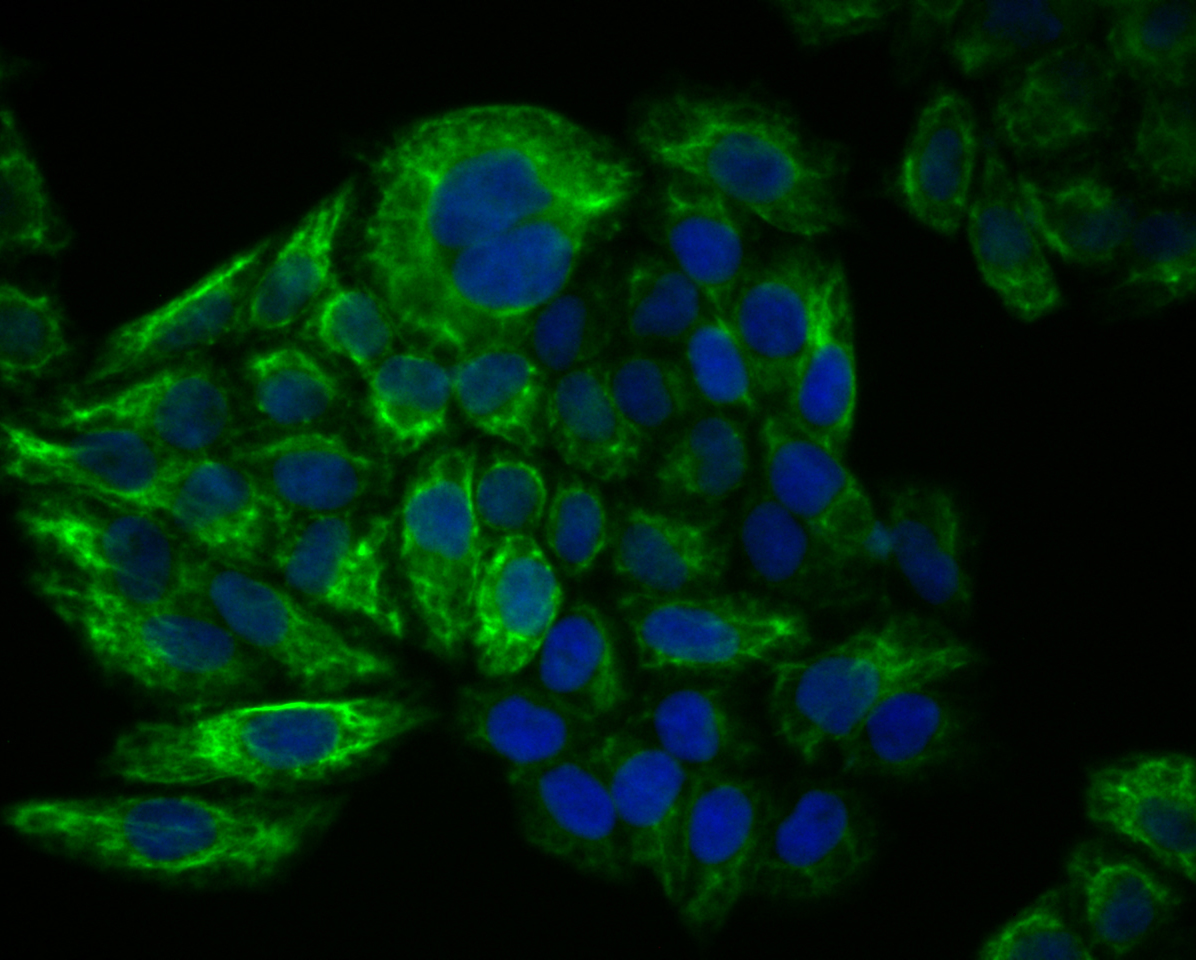 ICC staining of Cytokeratin 17 in Hela cells (green). Formalin fixed cells were permeabilized with 0.1% Triton X-100 in TBS for 10 minutes at room temperature and blocked with 1% Blocker BSA for 15 minutes at room temperature. Cells were probed with the primary antibody (ER1901-18, 1/50) for 1 hour at room temperature, washed with PBS. Alexa Fluor®488 Goat anti-Rabbit IgG was used as the secondary antibody at 1/1,000 dilution. The nuclear counter stain is DAPI (blue).