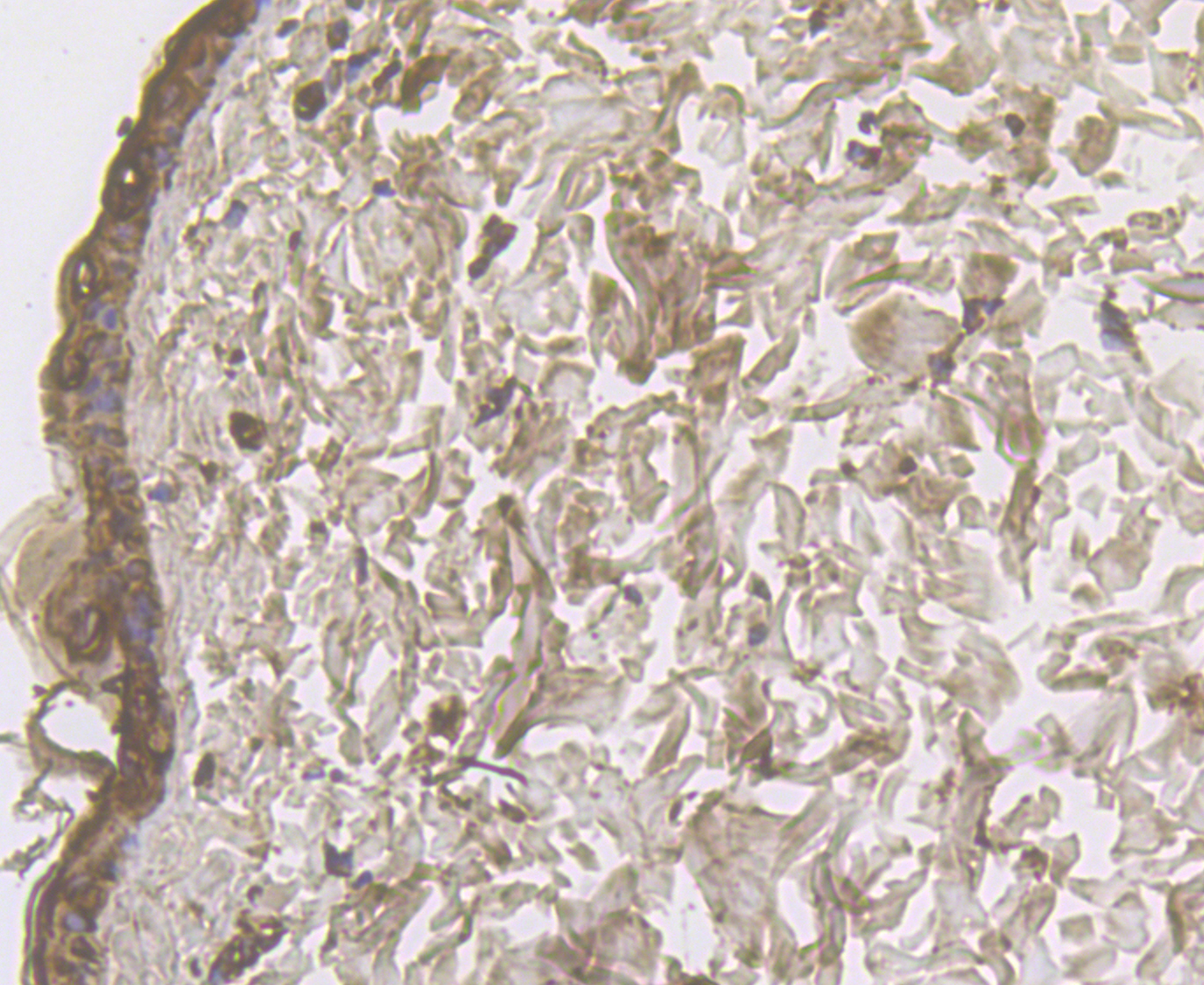 Immunohistochemical analysis of paraffin-embedded rat skin tissue using anti-Cytokeratin 17 antibody. The section was pre-treated using heat mediated antigen retrieval with Tris-EDTA buffer (pH 8.0-8.4) for 20 minutes.The tissues were blocked in 5% BSA for 30 minutes at room temperature, washed with ddH2O and PBS, and then probed with the antibody (ER1901-18) at 1/50 dilution, for 30 minutes at room temperature and detected using an HRP conjugated compact polymer system. DAB was used as the chromogen. Counter stained with hematoxylin and mounted with DPX.