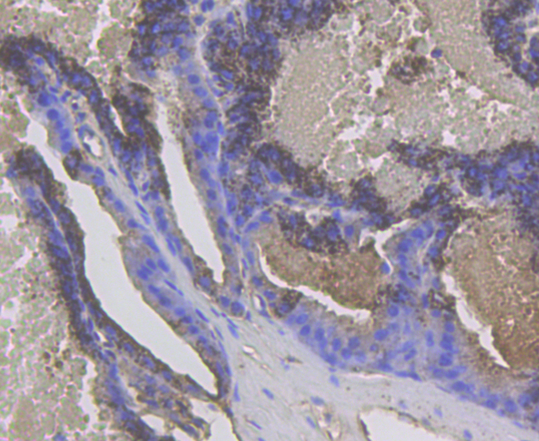 Immunohistochemical analysis of paraffin-embedded mouse prostate tissue using anti-Cytokeratin 17 antibody. The section was pre-treated using heat mediated antigen retrieval with Tris-EDTA buffer (pH 8.0-8.4) for 20 minutes.The tissues were blocked in 5% BSA for 30 minutes at room temperature, washed with ddH2O and PBS, and then probed with the antibody (ER1901-18) at 1/200 dilution, for 30 minutes at room temperature and detected using an HRP conjugated compact polymer system. DAB was used as the chromogen. Counter stained with hematoxylin and mounted with DPX.