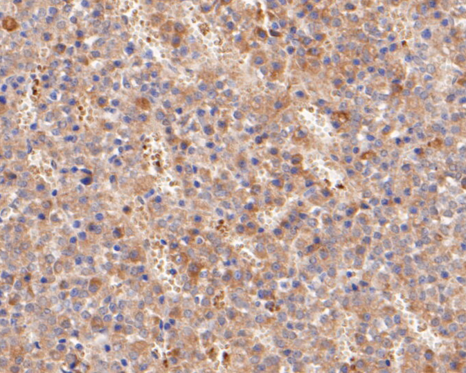 Immunohistochemical analysis of paraffin-embedded rat pituitary tissue using anti-FSH beta antibody. The section was pre-treated using heat mediated antigen retrieval with Tris-EDTA buffer (pH 8.0-8.4) for 20 minutes.The tissues were blocked in 5% BSA for 30 minutes at room temperature, washed with ddH2O and PBS, and then probed with the primary antibody (ER1901-19, 1/50) for 30 minutes at room temperature. The detection was performed using an HRP conjugated compact polymer system. DAB was used as the chromogen. Tissues were counterstained with hematoxylin and mounted with DPX.