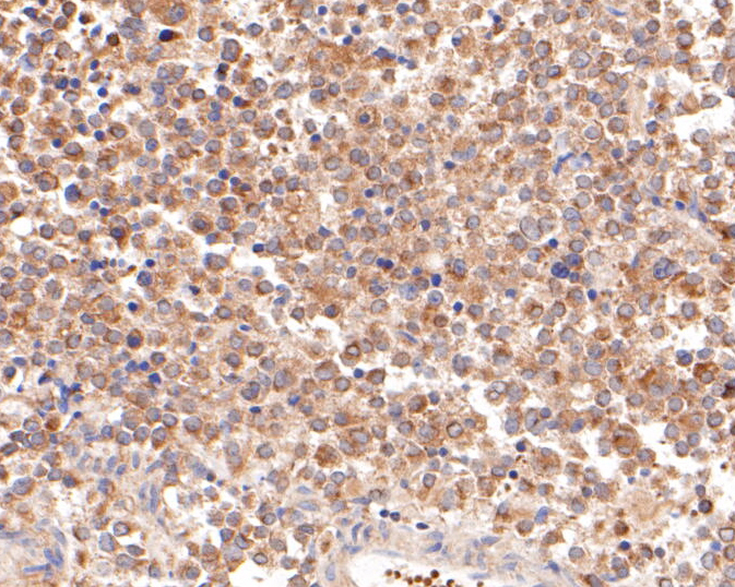 Immunohistochemical analysis of paraffin-embedded human pituitary tissue using anti-FSH beta antibody. The section was pre-treated using heat mediated antigen retrieval with Tris-EDTA buffer (pH 8.0-8.4) for 20 minutes.The tissues were blocked in 5% BSA for 30 minutes at room temperature, washed with ddH2O and PBS, and then probed with the primary antibody (ER1901-19, 1/200) for 30 minutes at room temperature. The detection was performed using an HRP conjugated compact polymer system. DAB was used as the chromogen. Tissues were counterstained with hematoxylin and mounted with DPX.