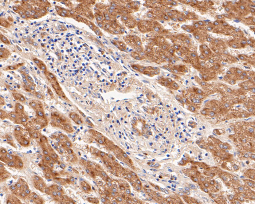 Immunohistochemical analysis of paraffin-embedded human liver tissue using anti-FSH beta antibody. The section was pre-treated using heat mediated antigen retrieval with Tris-EDTA buffer (pH 8.0-8.4) for 20 minutes.The tissues were blocked in 5% BSA for 30 minutes at room temperature, washed with ddH2O and PBS, and then probed with the primary antibody (ER1901-19, 1/50) for 30 minutes at room temperature. The detection was performed using an HRP conjugated compact polymer system. DAB was used as the chromogen. Tissues were counterstained with hematoxylin and mounted with DPX.