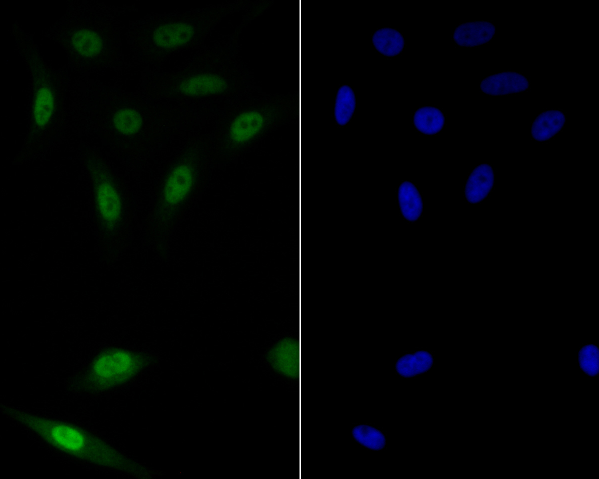 ICC staining of GATA3 in MCF-7 cells (green). Formalin fixed cells were permeabilized with 0.1% Triton X-100 in TBS for 10 minutes at room temperature and blocked with 1% Blocker BSA for 15 minutes at room temperature. Cells were probed with the primary antibody (ER1901-20, 1/50) for 1 hour at room temperature, washed with PBS. Alexa Fluor®488 Goat anti-Rabbit IgG was used as the secondary antibody at 1/1,000 dilution. The nuclear counter stain is DAPI (blue).