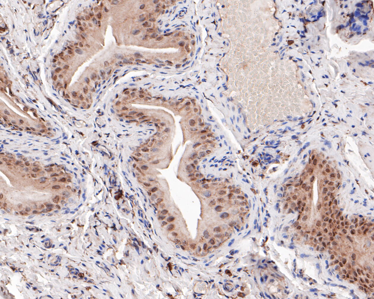 Immunohistochemical analysis of paraffin-embedded rat bladder tissue using anti-GATA3 antibody. The section was pre-treated using heat mediated antigen retrieval with sodium citrate buffer (pH 6.0) for 20 minutes. The tissues were blocked in 5% BSA for 30 minutes at room temperature, washed with ddH2O and PBS, and then probed with the primary antibody (ER1901-20, 1/200)  for 30 minutes at room temperature. The detection was performed using an HRP conjugated compact polymer system. DAB was used as the chromogen. Tissues were counterstained with hematoxylin and mounted with DPX.