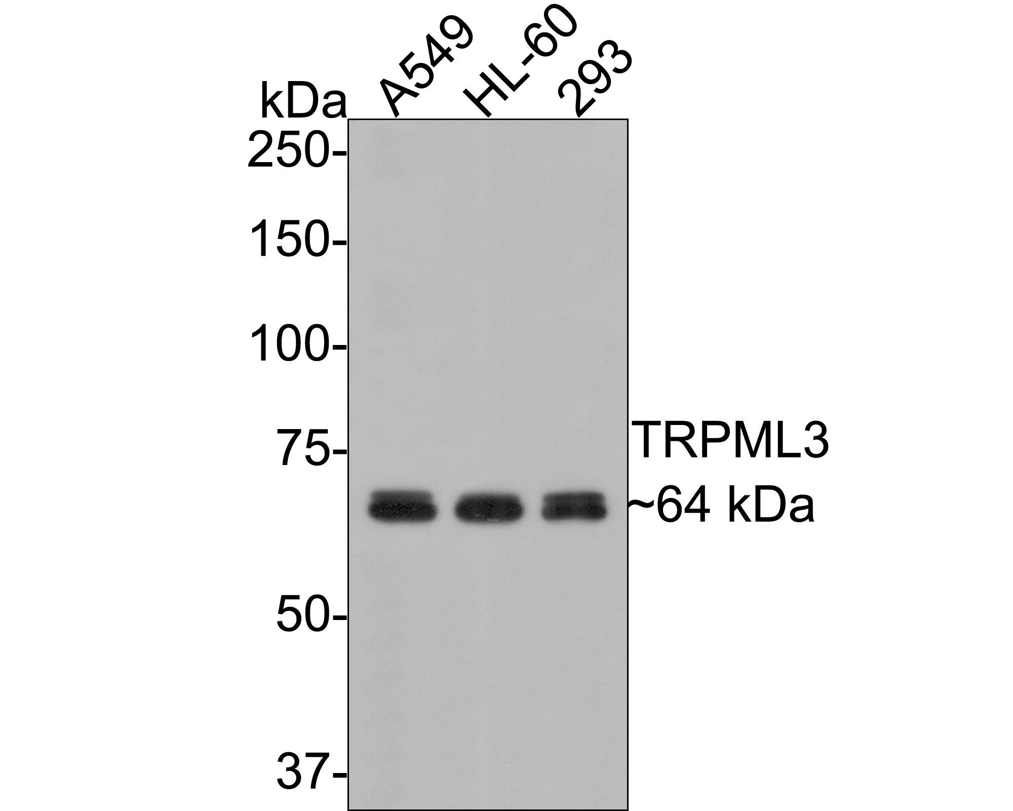 Western blot analysis of TRPML3 on different lysates with Rabbit anti-TRPML3 antibody (ER1901-21) at 1/2,000 dilution.<br />
<br />
Lane 1: A549 cell lysate<br />
Lane 2: HL-60 cell lysate<br />
Lane 3: 293 cell lysate<br />
<br />
Lysates/proteins at 10 µg/Lane.<br />
<br />
Predicted band size: 64 kDa<br />
Observed band size: 64 kDa<br />
<br />
Exposure time: 1 minute;<br />
<br />
8% SDS-PAGE gel.<br />
<br />
Proteins were transferred to a PVDF membrane and blocked with 5% NFDM/TBST for 1 hour at room temperature. The primary antibody (ER1901-21) at 1/2,000 dilution was used in 5% NFDM/TBST at room temperature for 2 hours. Goat Anti-Rabbit IgG - HRP Secondary Antibody (HA1001) at 1:300,000 dilution was used for 1 hour at room temperature.