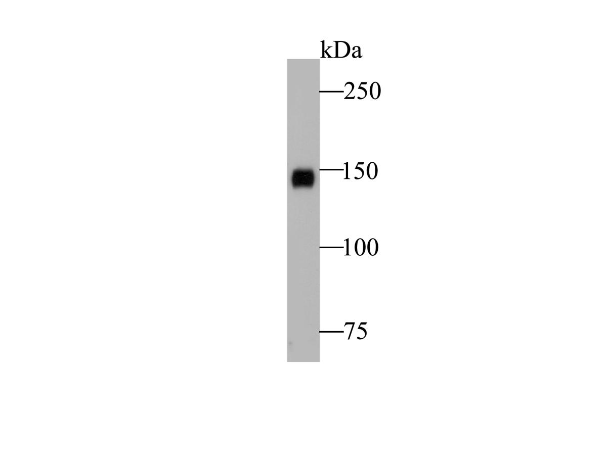 Western blot analysis of CD163 on human liver tissue lysate. Proteins were transferred to a PVDF membrane and blocked with 5% BSA in PBS for 1 hour at room temperature. The primary antibody (ER1901-22, 1/500) was used in 5% BSA at room temperature for 2 hours. Goat Anti-Rabbit IgG - HRP Secondary Antibody (HA1001) at 1:5,000 dilution was used for 1 hour at room temperature.