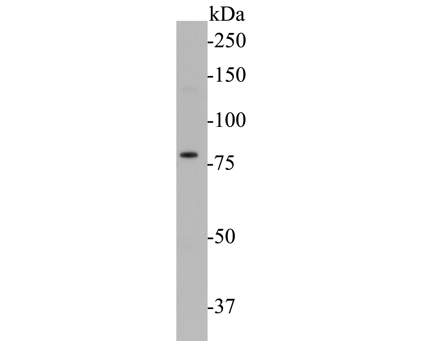 Western blot analysis of KV1.1 on rat brain tissue lysate. Proteins were transferred to a PVDF membrane and blocked with 5% BSA in PBS for 1 hour at room temperature. The primary antibody (ER1901-23, 1/500) was used in 5% BSA at room temperature for 2 hours. Goat Anti-Rabbit IgG - HRP Secondary Antibody (HA1001) at 1:5,000 dilution was used for 1 hour at room temperature.