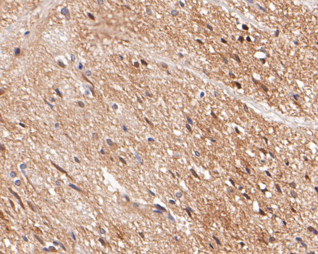 Immunohistochemical analysis of paraffin-embedded rat spinal cord tissue using anti-KV1.1 antibody. The section was pre-treated using heat mediated antigen retrieval with Tris-EDTA buffer (pH 8.0-8.4) for 20 minutes.The tissues were blocked in 5% BSA for 30 minutes at room temperature, washed with ddH2O and PBS, and then probed with the primary antibody (ER1901-23, 1/200) for 30 minutes at room temperature. The detection was performed using an HRP conjugated compact polymer system. DAB was used as the chromogen. Tissues were counterstained with hematoxylin and mounted with DPX.