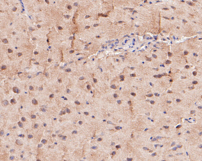 Immunohistochemical analysis of paraffin-embedded mouse brain tissue using anti-KV1.1 antibody. The section was pre-treated using heat mediated antigen retrieval with Tris-EDTA buffer (pH 8.0-8.4) for 20 minutes.The tissues were blocked in 5% BSA for 30 minutes at room temperature, washed with ddH2O and PBS, and then probed with the primary antibody (ER1901-23, 1/200) for 30 minutes at room temperature. The detection was performed using an HRP conjugated compact polymer system. DAB was used as the chromogen. Tissues were counterstained with hematoxylin and mounted with DPX.