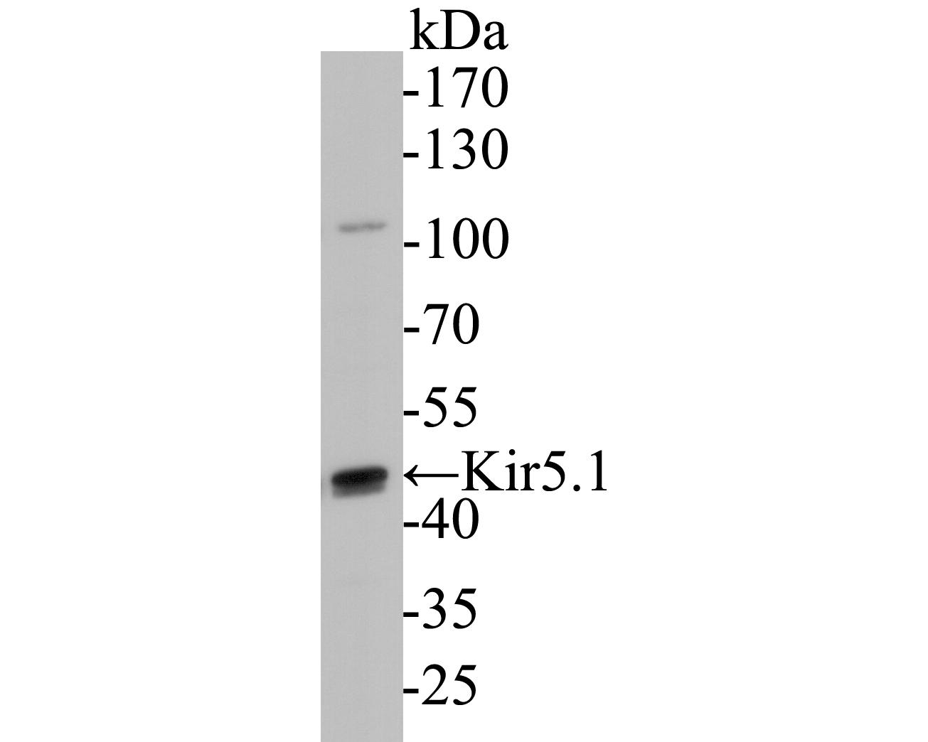 Western blot analysis of Kir5.1 on mouse kidney tissue lysate. Proteins were transferred to a PVDF membrane and blocked with 5% BSA in PBS for 1 hour at room temperature. The primary antibody (ER1901-24, 1/2000) was used in 5% BSA at room temperature for 2 hours. Goat Anti-Rabbit IgG - HRP Secondary Antibody (HA1001) at 1:5,000 dilution was used for 1 hour at room temperature.