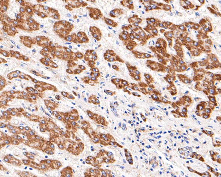 Immunohistochemical analysis of paraffin-embedded human liver tissue using anti-Kir5.1 antibody. The section was pre-treated using heat mediated antigen retrieval with Tris-EDTA buffer (pH 8.0-8.4) for 20 minutes.The tissues were blocked in 5% BSA for 30 minutes at room temperature, washed with ddH2O and PBS, and then probed with the primary antibody (ER1901-24, 1/200) for 30 minutes at room temperature. The detection was performed using an HRP conjugated compact polymer system. DAB was used as the chromogen. Tissues were counterstained with hematoxylin and mounted with DPX.