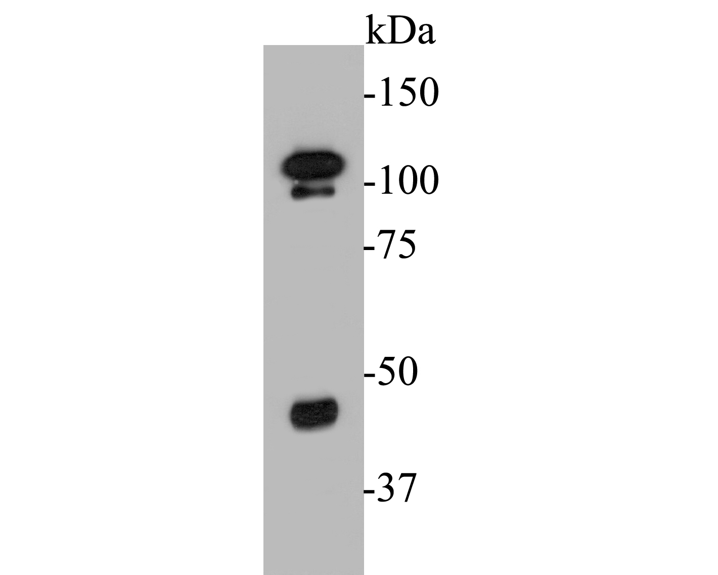 Western blot analysis of FoxP1 on mouse testis tissue lysates. Proteins were transferred to a PVDF membrane and blocked with 5% BSA in PBS for 1 hour at room temperature. The primary antibody (ER1901-25, 1/500) was used in 5% BSA at room temperature for 2 hours. Goat Anti-Rabbit IgG - HRP Secondary Antibody (HA1001) at 1:5,000 dilution was used for 1 hour at room temperature.